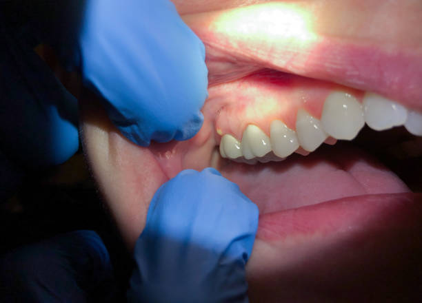 Best Pediatric Emergency Dentist in Warren Park, IN